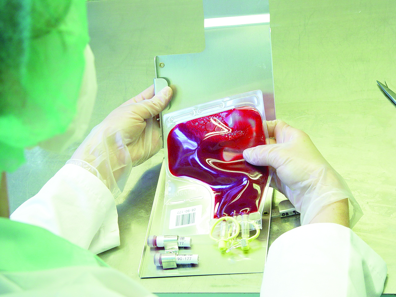 Justiça determina transfusão de sangue em recém-nascido sobrepondo questão religiosa